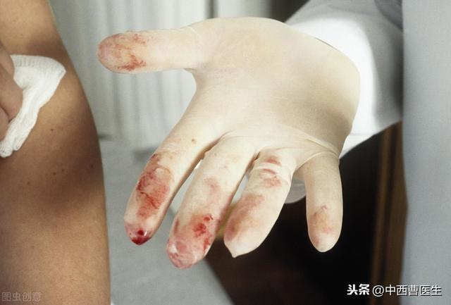 感染hpv主要会出现什么症状（身体会有哪些信号出现呢）(3)