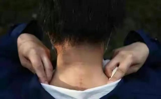 八达岭老虎伤人事件争议焦点（轰动一时的八达岭老虎咬人案）(9)