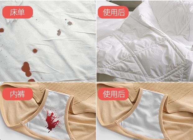 白衣服血渍清洗小妙招