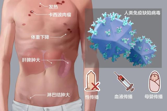 目前艾滋病最长活了多久（艾滋病究竟可以活多久）(4)