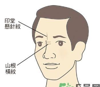 山根是什么部位相图：山根是什么