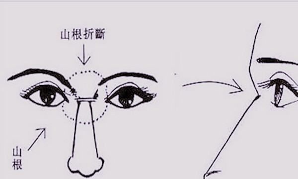 山根是什么部位相图,山根是哪里图片图2