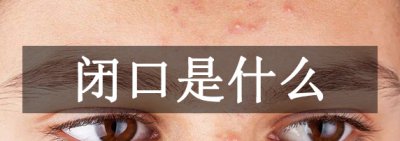 ​关口是什么?脸上毛孔阻碍引导的杰出_关口性粉刺