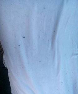 ​衣服上的霉斑对身体有害,衣服上的霉斑对身体有害吗