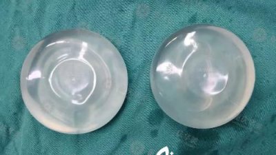 ​假体三套是啥,如何认定第三套房产