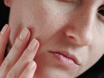 ​脸颊毛孔大 脸颊上的毛孔突出好难看怎么办？毛孔粗大的原因及改善方法推荐
