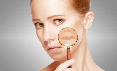 ​黄褐斑吃什么药可以去除（七种黄褐斑治疗药物简介）