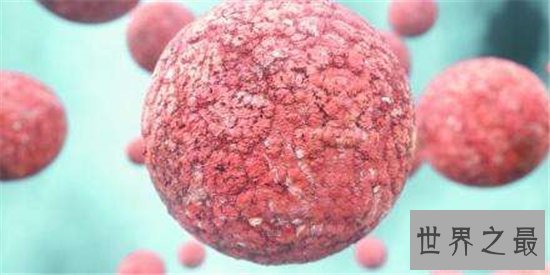 十大致命类型的癌症,都是很难治愈的癌症!