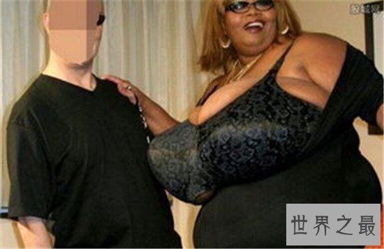世界上最大的天然乳房,双乳重达77斤(图)