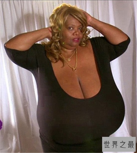 世界上最大的天然乳房,双乳重达77斤(图)