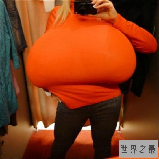 世界上最大的天然乳房,双乳重达77斤(图)