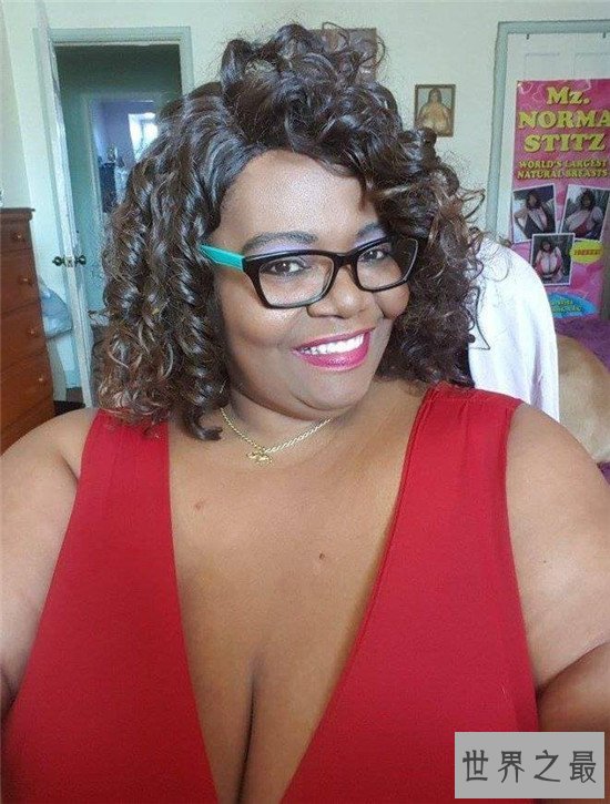 世界上最大的天然乳房,双乳重达77斤(图)