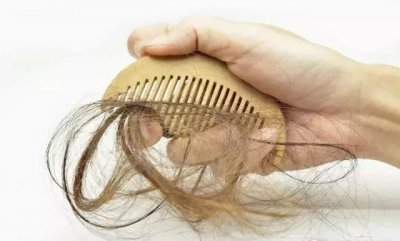 ​头发掉是什么病（拿什么拯救你我的头发，脱发可能是得了这6种病）