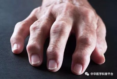 ​吸烟的危害有哪些 吸烟的危害