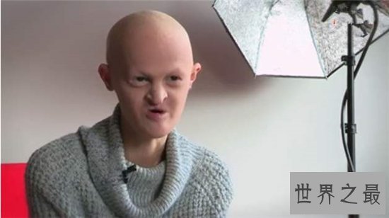 世界十大罕见病,到现在还没有解决的办法!