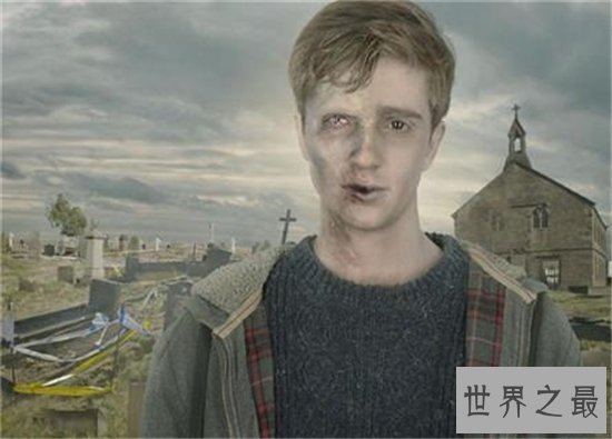 世界十大罕见病,到现在还没有解决的办法!