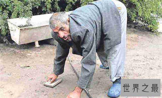 世界十大罕见病,到现在还没有解决的办法!