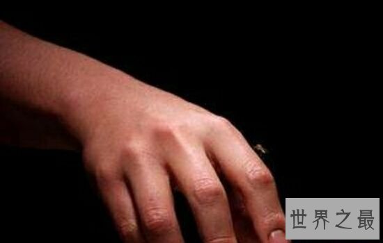 蚊子喜欢叮咬什么血型的人,看看你是不是蚊子最喜欢的那个人。