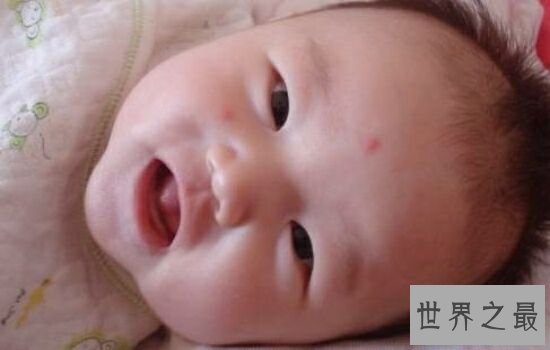 蚊子喜欢叮咬什么血型的人,看看你是不是蚊子最喜欢的那个人。