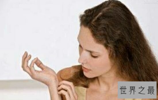 蚊子喜欢叮咬什么血型的人,看看你是不是蚊子最喜欢的那个人。