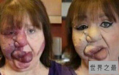 ​世界上最恶心的人，恶心到吃不下饭。