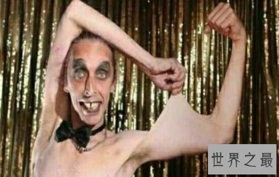 世界上皮肤最有弹性的人，最有弹性是什么概念呢？