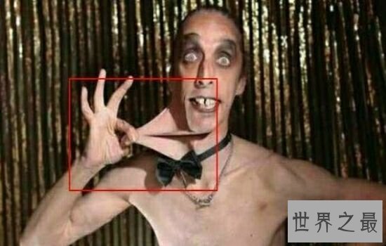 世界上皮肤最有弹性的人，最有弹性是什么概念呢？