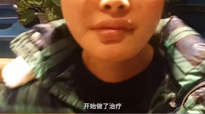 ​下巴整形大概多少钱 24岁女孩花4万元整容下颌手术变歪嘴，哭诉我还没有结婚呢