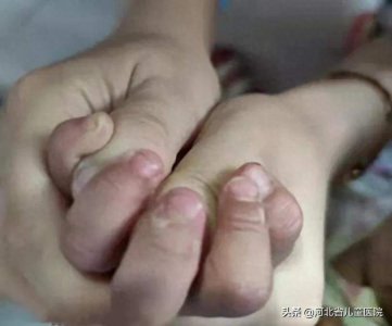 ​你没有听说过的“川崎病”，了解一下