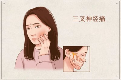 ​三叉神经痛的最佳解决办法 三叉神经痛怎样能根治