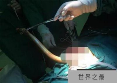 ​鳝鱼最近很火，它是怎么交配的?不远万里跑到奇怪的地方交配