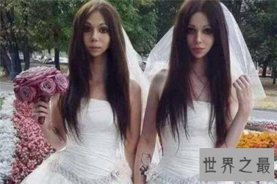 ​阴阳人图片形成原因介绍 泰国人妖并不属于阴阳人