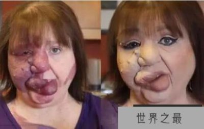 ​世界上最恶心的人,图片看一眼吃不下饭(又丑又恶心)