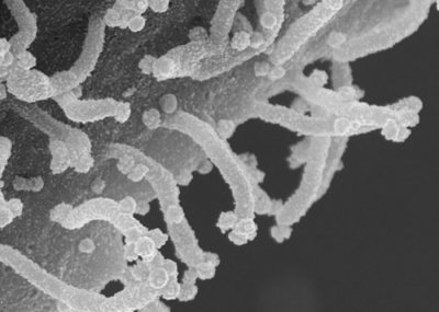 ​美国研究发现新冠病毒会令受感染的人体细胞“僵尸化” 长出“触须”