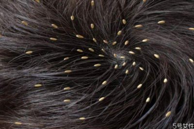 ​头发容易出油怎么办 头发容易出油怎么解决