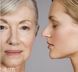 皮肤松弛怎么恢复 这样预防皮肤松弛