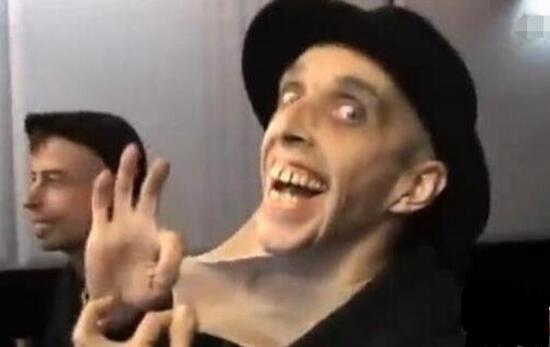 盘点世界上真实存在的橡胶人，堪称真人版路飞