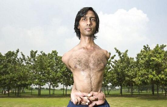 盘点世界上真实存在的橡胶人，堪称真人版路飞