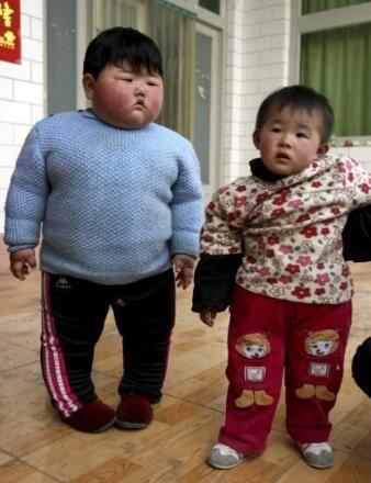 盘点世界上真实存在的橡胶人，堪称真人版路飞