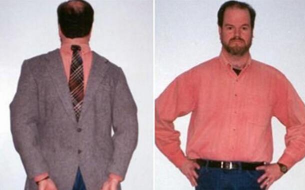 盘点世界上真实存在的橡胶人，堪称真人版路飞