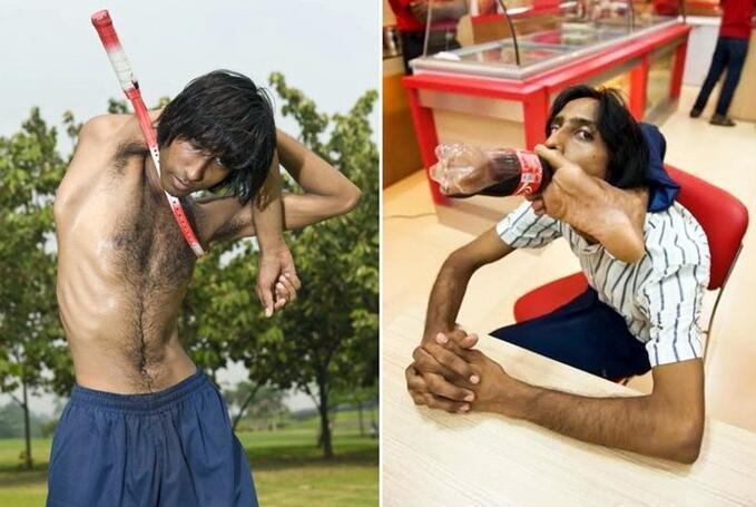 盘点世界上真实存在的橡胶人，堪称真人版路飞