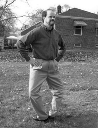 盘点世界上真实存在的橡胶人，堪称真人版路飞