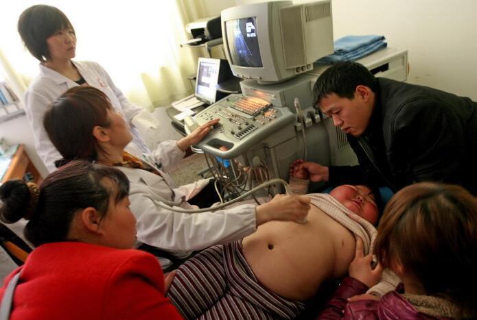 盘点世界上真实存在的橡胶人，堪称真人版路飞