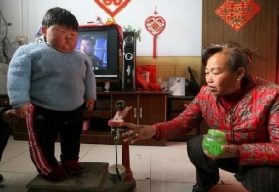 盘点世界上真实存在的橡胶人，堪称真人版路飞