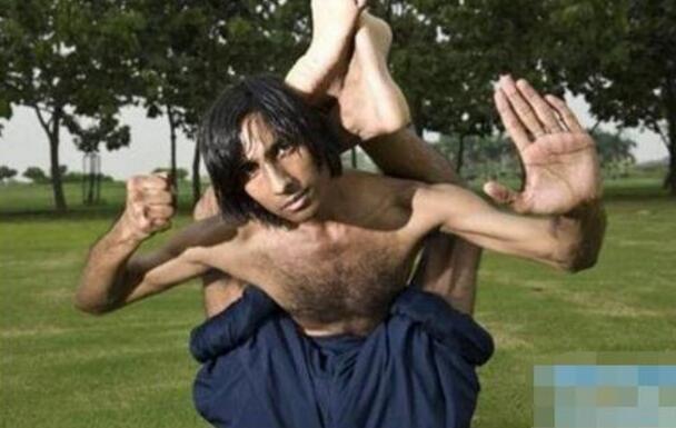 盘点世界上真实存在的橡胶人，堪称真人版路飞