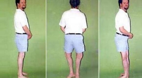 盘点世界上真实存在的橡胶人，堪称真人版路飞