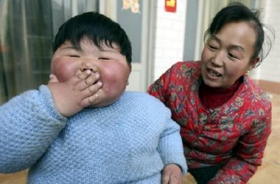 盘点世界上真实存在的橡胶人，堪称真人版路飞