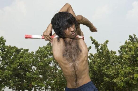 盘点世界上真实存在的橡胶人，堪称真人版路飞