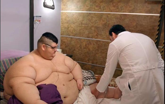 世界上体重最重的人，最高达到1180斤？三年能减掉850斤？