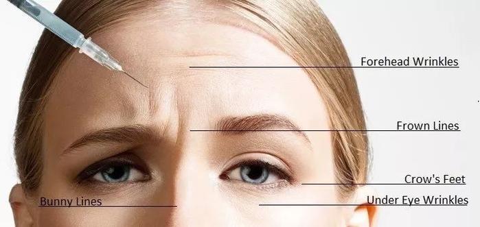 “表情包”龙妈下线，她标志性的抬头纹怎么不见了？！